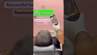 Successful hair growth treatment…☺️  drlifefix youtubeshorts [upl. by Loss17]