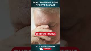 Early Warning Signs of Liver Disease [upl. by Yhtac915]