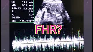 U Tell Me Baby Gender On Ultrasound 🙂  FHRV Cephalic or Breech  Placenta Posterior or Anterior [upl. by Nickelsen]