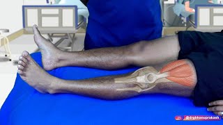 Knee Joint Examination  OSCE Orthopedics  Clinical essentials [upl. by Tia]