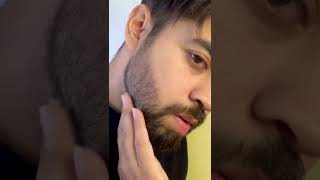 How to fix your PATCHY beard HACK shorts beard beardgrowth [upl. by Lytsirhc]