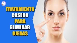 Tratamiento casero para eliminar las ojeras [upl. by Bard]