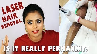 THINGS NOONE TELLS YOU ABOUT LASER HAIR REMOVAL  ON BROWN SKIN [upl. by Anircam939]