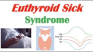 Euthyroid Sick Syndrome Nonthyroidal Illness Syndrome Causes Symptoms Diagnosis Treatment [upl. by Penoyer]