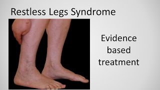 Restless Leg Syndrome evidence based treatment [upl. by Airotnes]