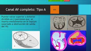 Canal Auriculo Ventricular [upl. by Breana]