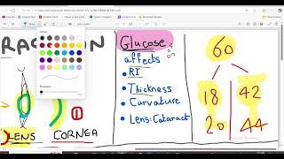 ERRORS OF REFRACTION  MYOPE VS HYPERMETROPE  MNEMONICS [upl. by Elbon]