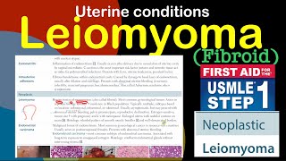 Leiomyoma [upl. by Chesnut]