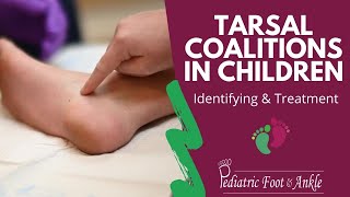 Identifying amp Treating Tarsal Coalitions in Children [upl. by Jdavie]