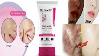 winter face wash  dr rashel skin whitening face wash effectsskin brightening face wash [upl. by Manas400]