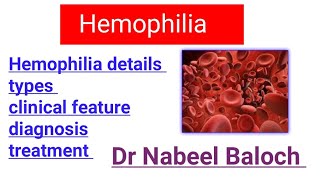 Hemophilia details lectures  Hematology [upl. by Mcdowell61]