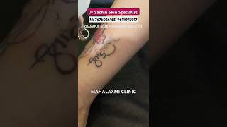 tattoo tattooremoval army belagavi indianarmy commando armylife physicaltranning fouji [upl. by Bonnie]