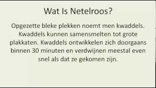 Netelroos  Wat Is Netelroos En Hoe Bestrijdt Je Het [upl. by Terencio]