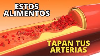 Alimentos que tapan tus arterias sin tu saber [upl. by Achorn]