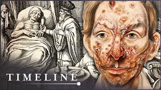 The True Terrors Of Tudor Medicine  Hidden Killers  Timeline [upl. by Alvita386]