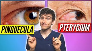 Eye Anatomy  Review and Quiz [upl. by Ateuqirne]