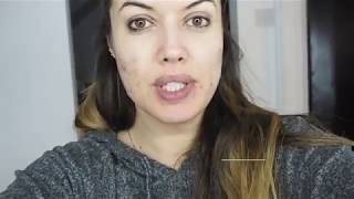 Roaccutane  Month 1  30mg  Skin Diary  Third Time Lucky  Super Gorgeous Blog [upl. by Irahs]