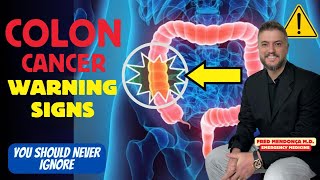 Does red meat cause colon cancer Colon Cancer Symptoms You Should Ignore [upl. by Lindsley]