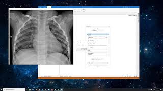 Detecting COVID  19 cases with RPA AI and Machine Learning  UiPath [upl. by Darn379]