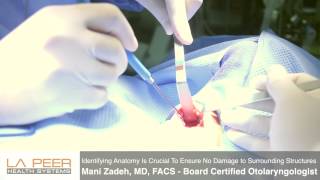 Watch Parathyroidectomy Surgery Performed by Dr Zadeh at La Peer Surgery Center [upl. by Quentin279]