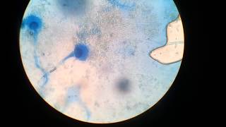 Aspergillus spp in LPCB mount [upl. by Ajram841]