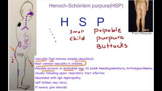 HenochSchönlein Purpura Mnemonic [upl. by Abelard284]