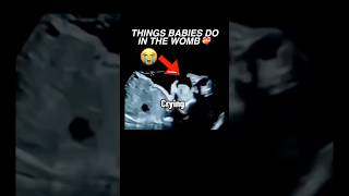 Things babies do in the womb ultrasound pregnancy baby cutebaby womenshealth [upl. by Frissell82]