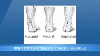 Foot Pronation And Supination  What Is The Difference [upl. by Maryann]