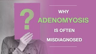 Adenomyosis Symptoms Why Adenomyosis Is Often Misdiagnosed And What to Do About It [upl. by Brier]