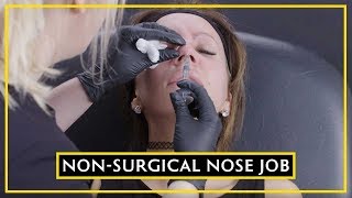 All About Using Dermal Fillers In The Nose [upl. by Targett829]