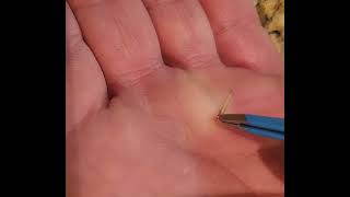 Removing large splinter from my hand [upl. by Winthorpe]