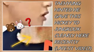 OMG💋😱Taehyung Hinted He Gave This Hickey To Jungkook Clearly Here RecentlyNewjungkooktaehyung [upl. by Barr891]