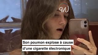 Son poumon explose à cause dune cigarette électronique 🫁😱 [upl. by Plumbo423]