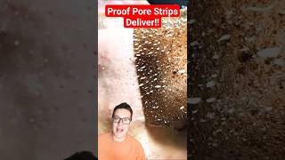 PROOF PORE STRIPS WORK  Phenomenal Pore Strip Removal shorts [upl. by Ahsiekar437]