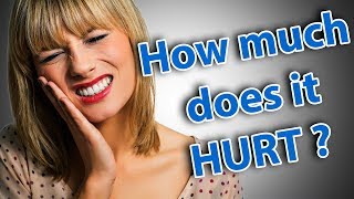 How much does the All on 4© Dental Implant procedure hurt [upl. by Konrad]