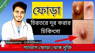 ফোড়া হলে করনিয় এবং ফোড়ার সঠিক চিকিৎসা  Abscess  Boil  Swapnomoy  Health advice31 [upl. by Lesko]