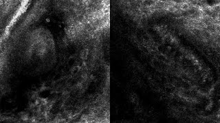 Adherent and Rolling Leukocytes in Intact Cutaneous Microvasculature via Confocal Videomicroscopy [upl. by Aynahs]