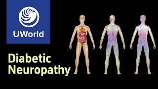 Diabetic Neuropathy  Pathophysiology Signs Symptoms  USMLE UWorld Step 1 Question MBBS MEDSTUDY [upl. by Anirtap]