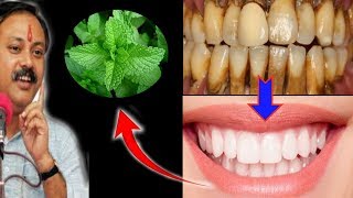 Magical Teeth whitening home remedy get whitening teeth at home in 5 minutes [upl. by Ailyn]