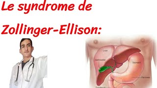 syndrome de zollinger ellison [upl. by Alie252]