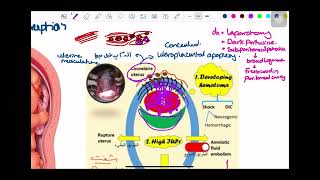 1 Antepartum Hge [upl. by Ezaria]