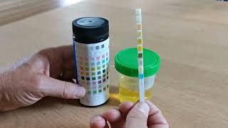 How to use urine test strips 10 parameters [upl. by Doownil]