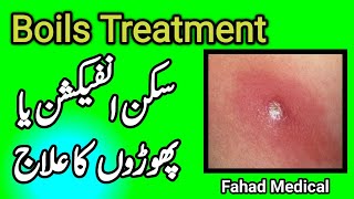 Muscle Boils Treatment in UurduHindi  Skin Infections  Phoron ka Elaj  Fahad Medical [upl. by Ahseuqal]