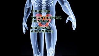 diastaseabdominal  inflamação no púbis  distenção na virilha hiperlordose lombar [upl. by Akinet]