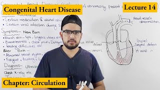 Congenital Heart Diseases Cardiovascular Disorders  Chapter Circulation video  14 [upl. by Kuehnel148]