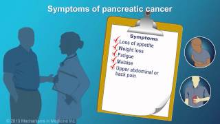 Pancreatic Cancer Signs Symptoms and Risk Factors [upl. by Eserrehs]