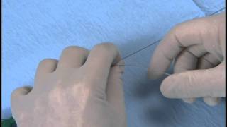 Angioplasty technique insertion of a balloon catheter [upl. by Yellhsa]