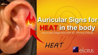 Identifying inflammation amp heat  Dr Jimmy Changs Auricular Diagnosis  Acupuncture CEU Course [upl. by Assilav]