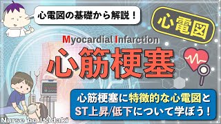 【心筋梗塞の心電図波形を学ぼう！】12誘導心電図の基本､ST上昇低下の仕組みを解説！ [upl. by Hoye315]