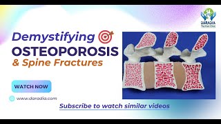 🦴📚Latest Osteoporosis Treatment amp Spine Fractures What a Physician Must Know👨‍⚕️🦴 [upl. by Marla]